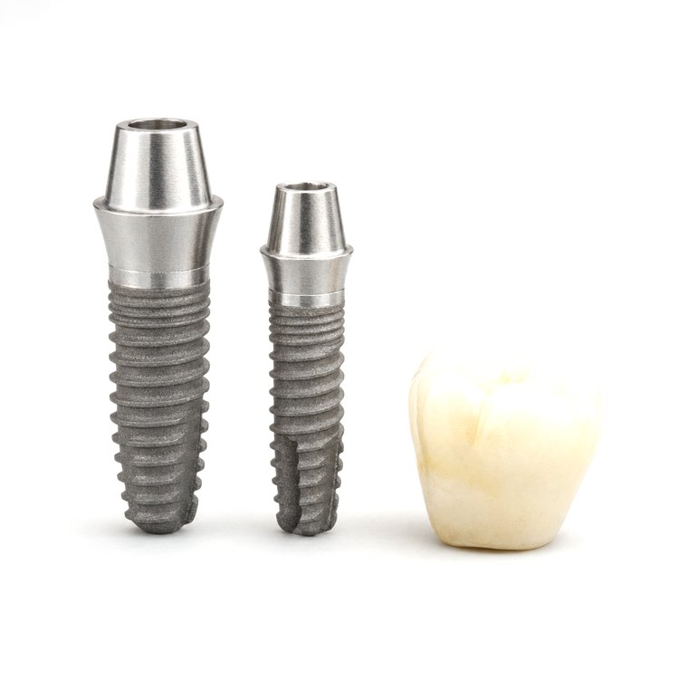 Two titanium implant posts beside a ceramic crown